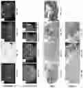 Fig. 17 - Systems, methods, and apparatus for multichannel imaging of fluorescent sources in real-time