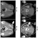 Fig. 18 - Systems, methods, and apparatus for multichannel imaging of fluorescent sources in real-time