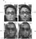 Fig. 01 - Pulse detection from head motions in video