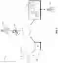 Fig. 02 - Cardiac arrhythmia report