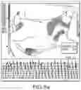 Fig. 07 - Methods and systems for generating integrated substrate maps for cardiac arrhythmias