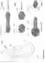 Fig. 09 - Methods and systems for vaginal therapeutic device fitting