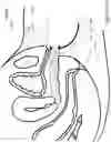 Fig. 19 - Methods and systems for vaginal therapeutic device fitting