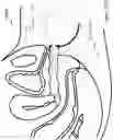 Fig. 20 - Methods and systems for vaginal therapeutic device fitting