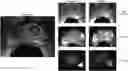 Fig. 01 - Automated co-registration of prostate MRI data