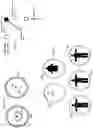 Fig. 11 - Systems And Methods For Managing Pressure Experienced By A Person Supported On A Support Surface
