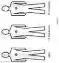 Fig. 13 - Systems And Methods For Managing Pressure Experienced By A Person Supported On A Support Surface