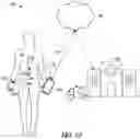 Fig. 08 - Method and apparatus for pain control using baroreflex sensitivity during posture change