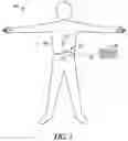 Fig. 02 - Pain management based on functional measurements