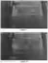 Fig. 25 - Medical fluid injection apparatus and method with detachable patch and monitoring