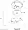 Fig. 37 - Medical fluid injection apparatus and method with detachable patch and monitoring
