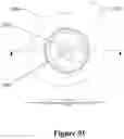 Fig. 64 - Medical fluid injection apparatus and method with detachable patch and monitoring