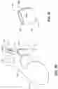 Fig. 09 - Electrode assemblies for neurostimulation treatment