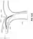 Fig. 100 - Electrode assemblies for neurostimulation treatment