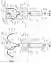 Fig. 13 - Electrode assemblies for neurostimulation treatment