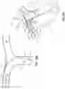 Fig. 29 - Electrode assemblies for neurostimulation treatment