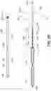 Fig. 30 - Electrode assemblies for neurostimulation treatment