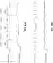 Fig. 63 - Electrode assemblies for neurostimulation treatment