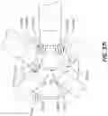 Fig. 79 - Electrode assemblies for neurostimulation treatment