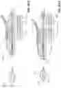 Fig. 83 - Electrode assemblies for neurostimulation treatment