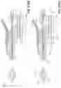 Fig. 84 - Electrode assemblies for neurostimulation treatment