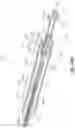Fig. 89 - Electrode assemblies for neurostimulation treatment