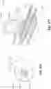 Fig. 90 - Electrode assemblies for neurostimulation treatment