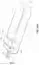 Fig. 91 - Electrode assemblies for neurostimulation treatment