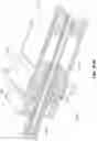 Fig. 92 - Electrode assemblies for neurostimulation treatment