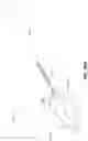 Fig. 93 - Electrode assemblies for neurostimulation treatment