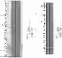 Fig. 14 - Determining a state of a solid tumor based on neural activity within the solid tumor