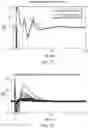 Fig. 16 - Determining a state of a solid tumor based on neural activity within the solid tumor