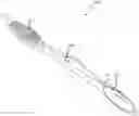 Fig. 01 - Diagnosis using a digital oral device