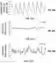 Fig. 28 - Systems and methods for cardiovascular-dynamics correlated imaging