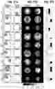 Fig. 30 - Systems and methods for cardiovascular-dynamics correlated imaging