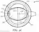 Fig. 10 - Ergonomic chestpiece