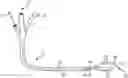 Fig. 01 - COAPTATION ULTRASOUND DEVICES AND METHODS OF USE
