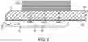 Fig. 06 - COAPTATION ULTRASOUND DEVICES AND METHODS OF USE