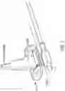 Fig. 07 - COAPTATION ULTRASOUND DEVICES AND METHODS OF USE