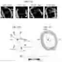 Fig. 06 - Systems and methods for rendering of cardiac electromechanical activation