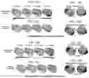 Fig. 11 - Systems and methods for rendering of cardiac electromechanical activation