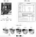 Fig. 35 - Systems and methods for rendering of cardiac electromechanical activation