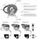 Fig. 36 - Systems and methods for rendering of cardiac electromechanical activation