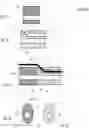 Fig. 03 - Smooth transition catheters
