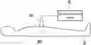 Fig. 01 - Ultrasonic scanning method and ultrasonic scanning device