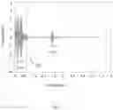 Fig. 05 - Intra-needle ultrasound system and its method of use for analysis, tracking, and display of pleura in millimeter scale resolution