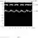 Fig. 08 - Intra-needle ultrasound system and its method of use for analysis, tracking, and display of pleura in millimeter scale resolution