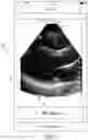 Fig. 12 - METHODS AND APPARATUSES FOR RECEIVING FEEDBACK FROM USERS REGARDING AUTOMATIC CALCULATIONS PERFORMED ON ULTRASOUND DATA