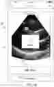 Fig. 20 - METHODS AND APPARATUSES FOR RECEIVING FEEDBACK FROM USERS REGARDING AUTOMATIC CALCULATIONS PERFORMED ON ULTRASOUND DATA