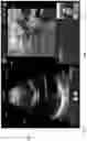 Fig. 04 - METHODS AND APPARATUSES FOR TELE-MEDICINE